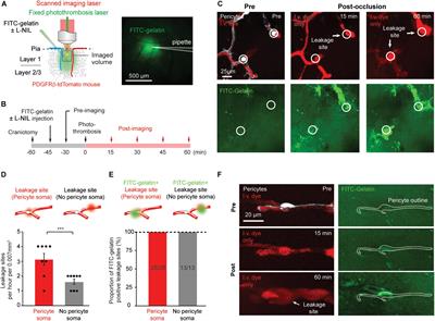 Rapid, Nitric Oxide Synthesis-Dependent Activation of MMP-9 at Pericyte Somata During Capillary Ischemia in vivo